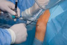 knee surgery.jpg